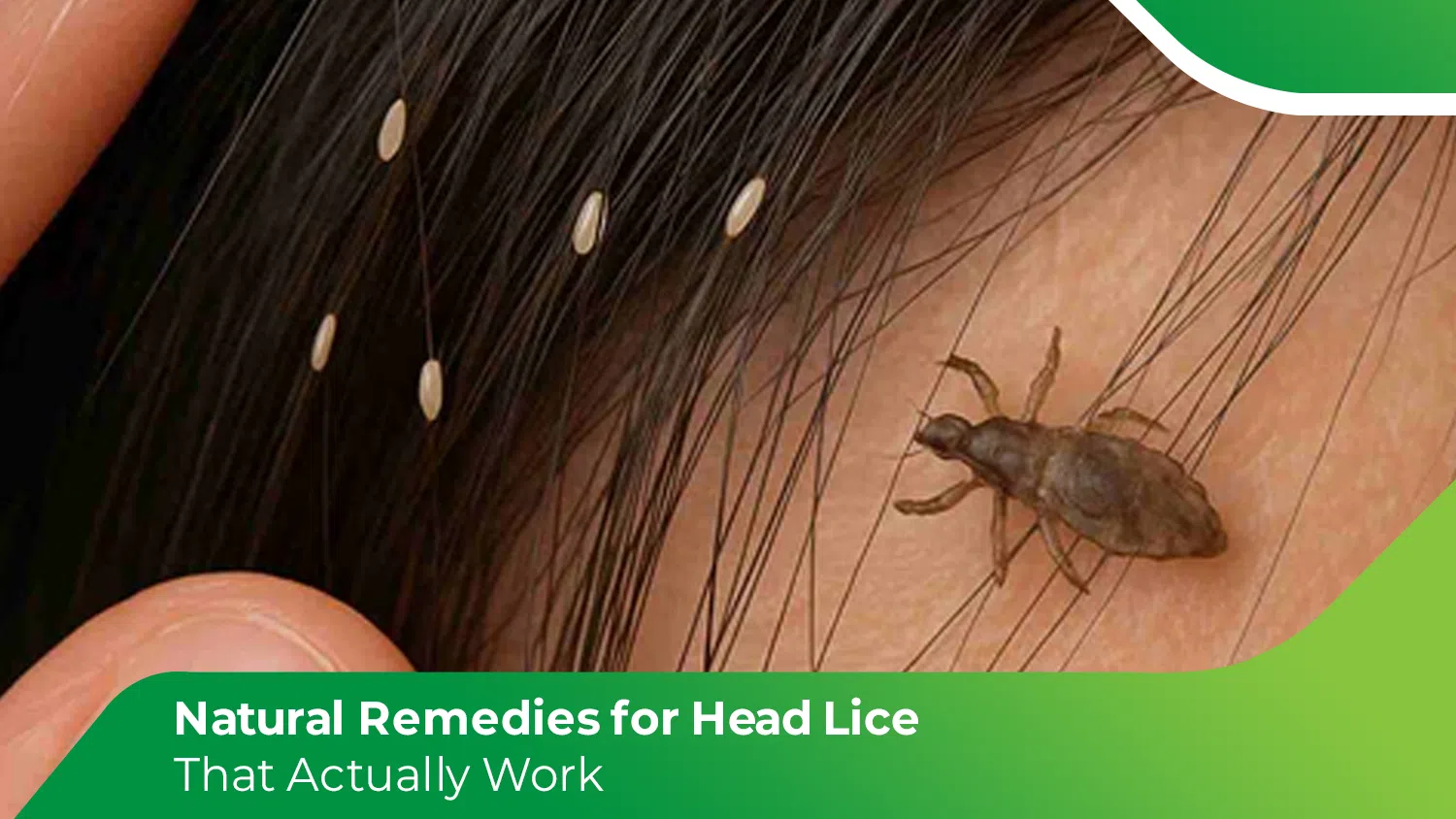 Natural Remedies for Head Lice
