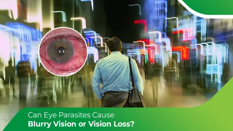 Blurred vision with red eye linked to eye parasites