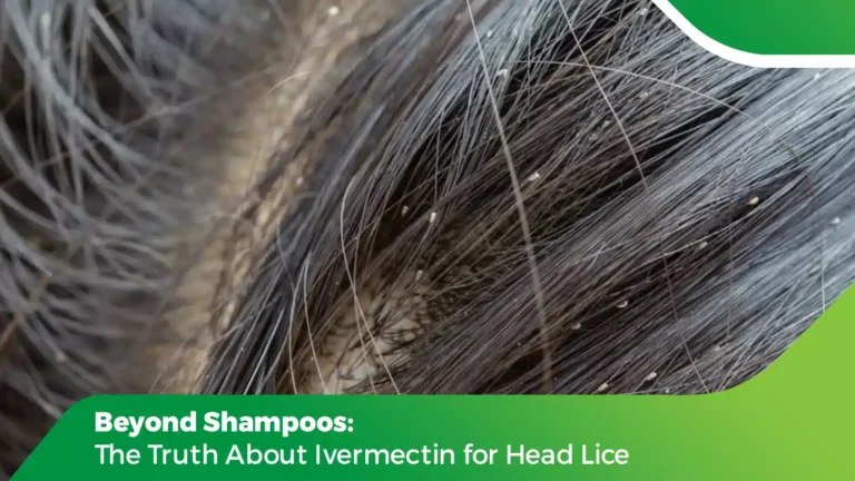 Person applying lice treatment while examining scalp closely for head lice removal using Ivermectin solution